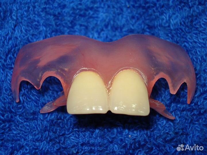 Зубные протезы