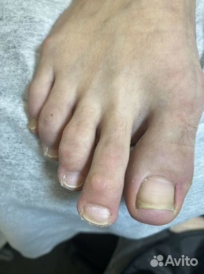 Педикюр Жуковский