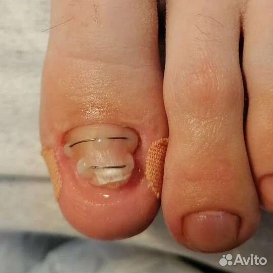 Услуги подолога