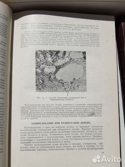 Дифференциальная диагностика заболеваний легких