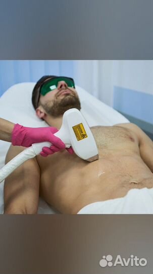 Лазерная эпиляция для мужчин и женщин