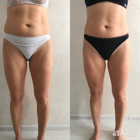 Антицеллюлитный массаж ручной