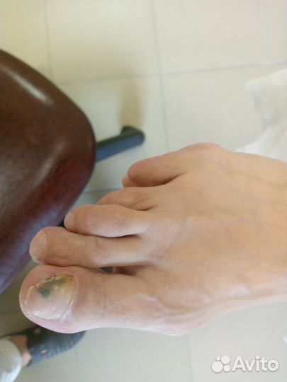 Услуги подолога