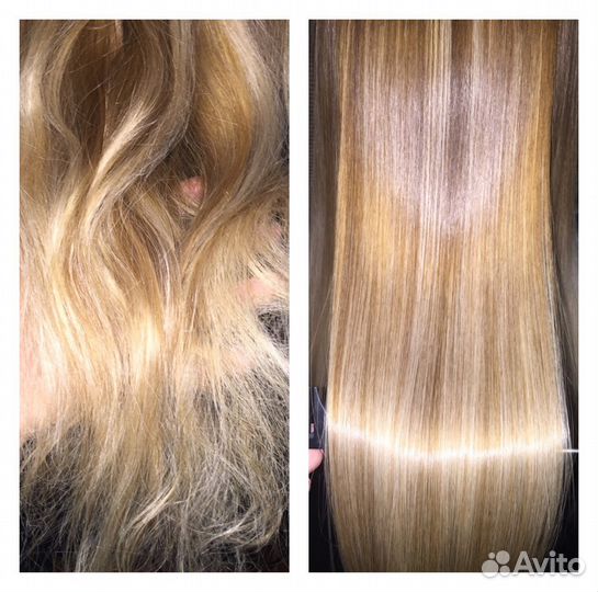 Нанопластика, ботокс, Биксипластия