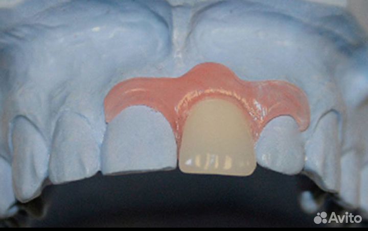 Зубной техник