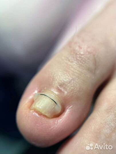 Педикюр,Подолог