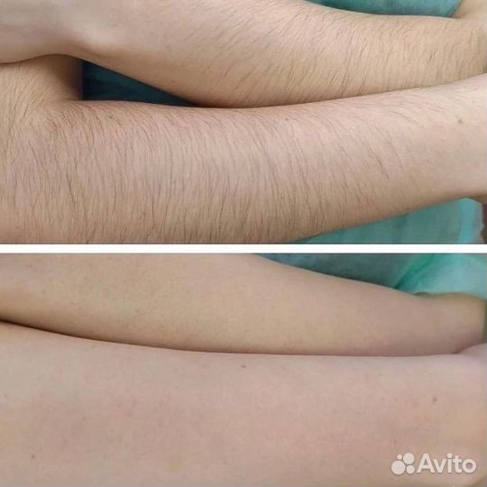 Ищу моделей