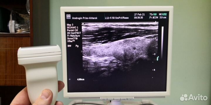 Сдаю в аренду узи аппарат, сканер ультразвуковой д