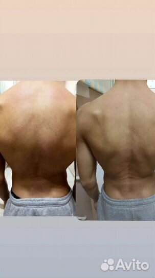 Массаж костоправ Оздоровительный массаж