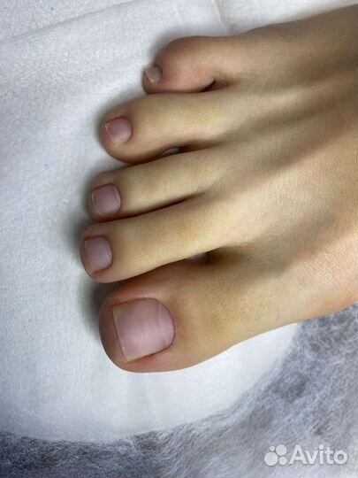 Педикюр (подолог)