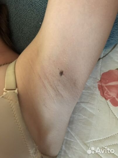 Восковая депиляция