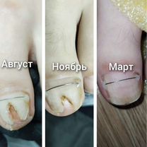 Подолог, большой опыт, безболезненно, качестванно, Москва