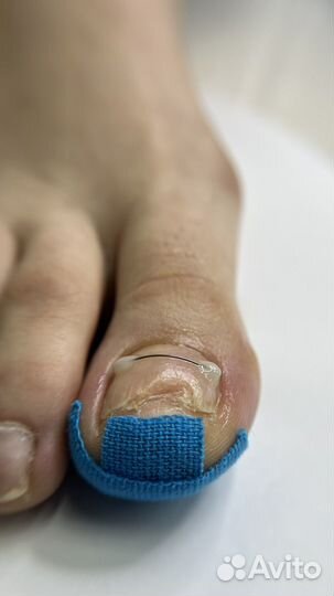 Курсы педикюра подология