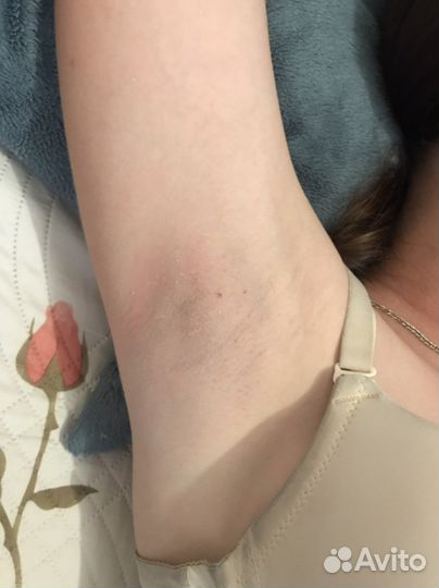 Восковая депиляция