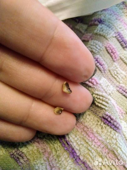 Ультразвуковая чистка зубов без стресса