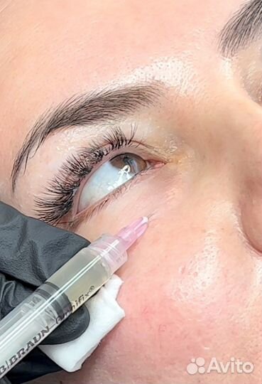 Биоревитализация