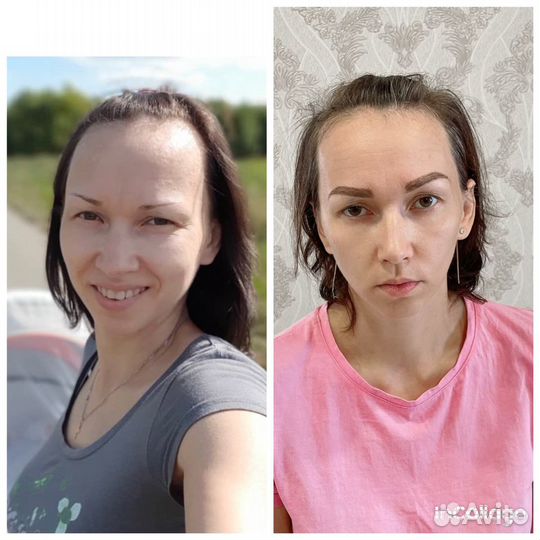 Консультация косметолога