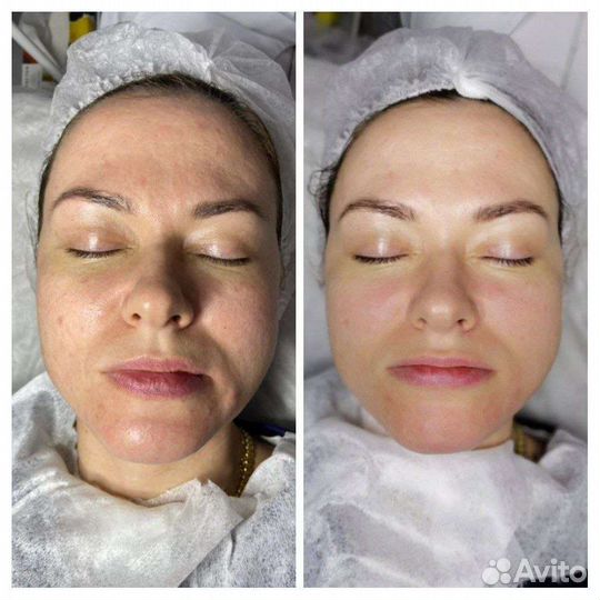 Услуги косметолога