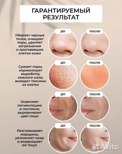 Ультразвуковая чистка лица