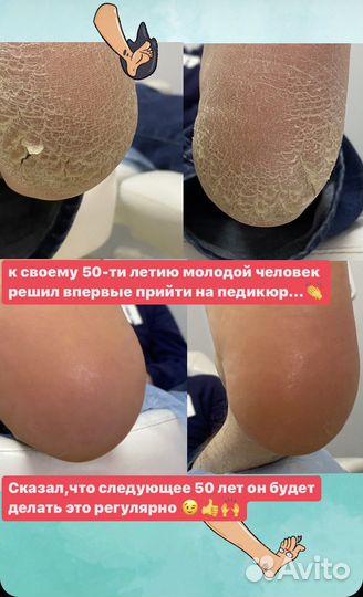 Медицинский и эстетический педикюр и маникюр