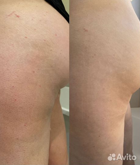 Подарок девушке, парню.Для ухода