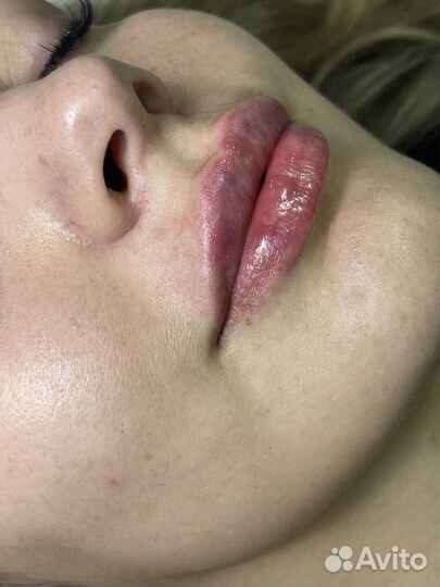 Услуги косметолога