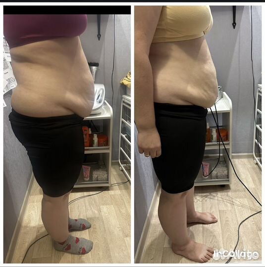 Коррекция фигуры