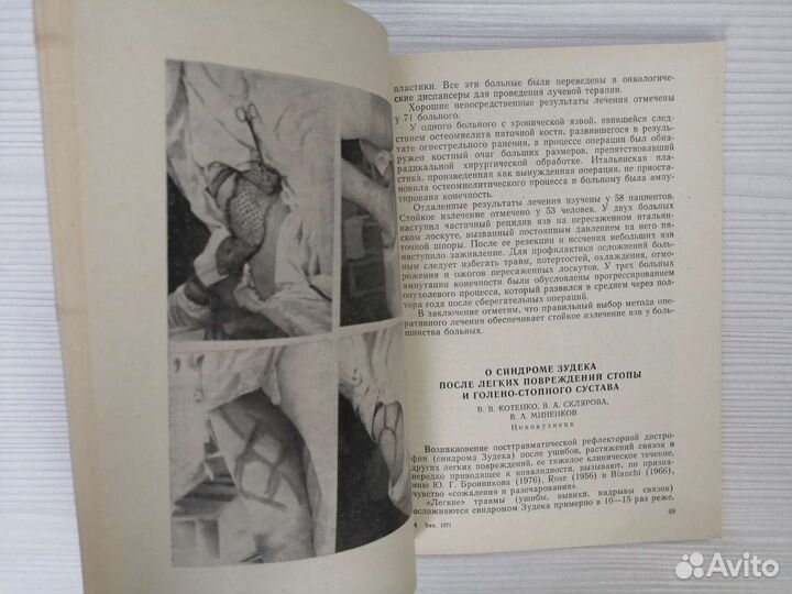 Повреждения и заболевания стопы (1979г.) / Сборник