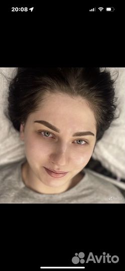 Увеличение губ