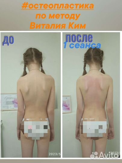 Лечебный массаж Остеопластика по метод Виталия Ким