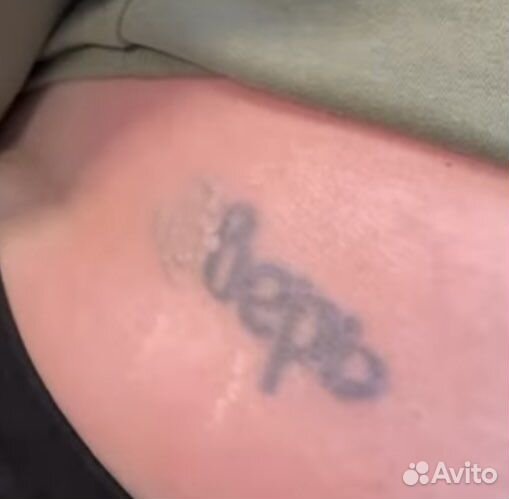 Удаление тату и татуажа