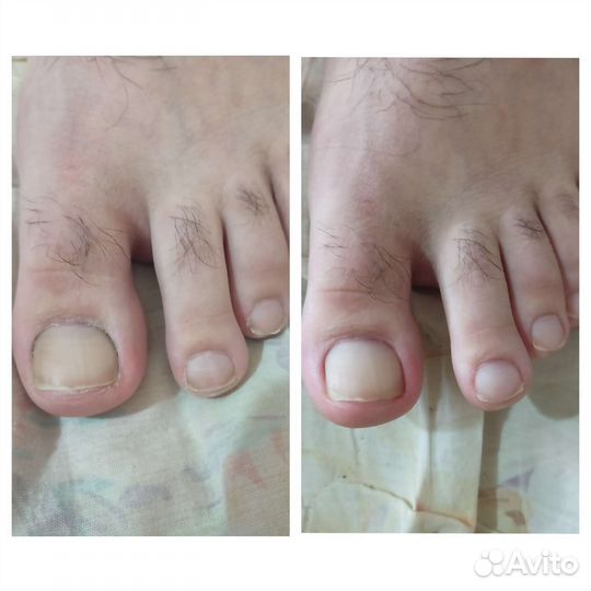 Смарт педикюр