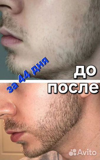 Лосьон для роста волос