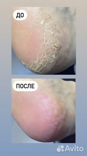 Подолог(педикюр)