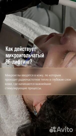 Микроигольчатый РФ лифтинг