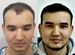 Пересадка волос в Москве за 1 день