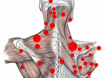Курсы массажа / Обучение триггерным точкам