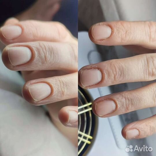 Услуги подолога, педикюр