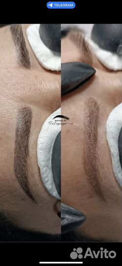 Модель на Удаление тату / Перманентного макияжа