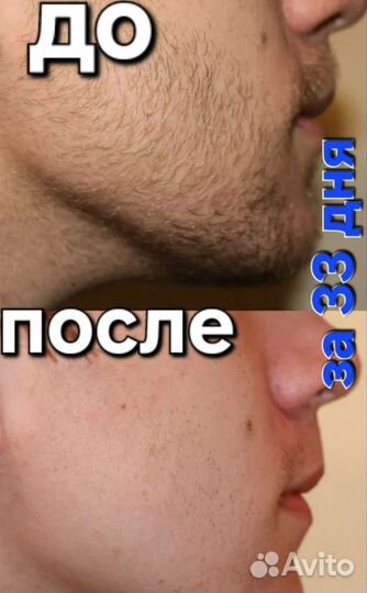 Лосьон для роста волос