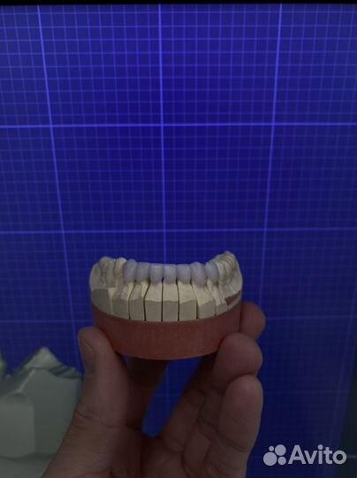 Обучение exocad cad cam