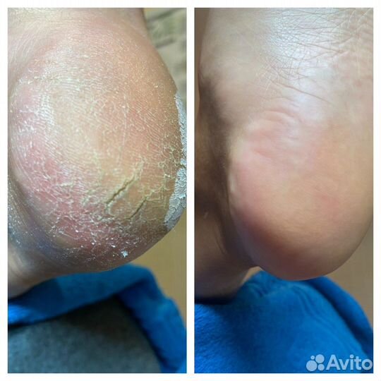 Подолог, Педикюр, маникюр любой сложности