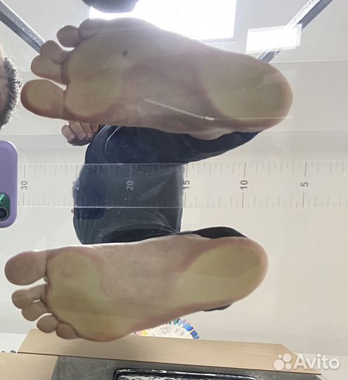 Изготовление индивидуальных ортопедических стелек