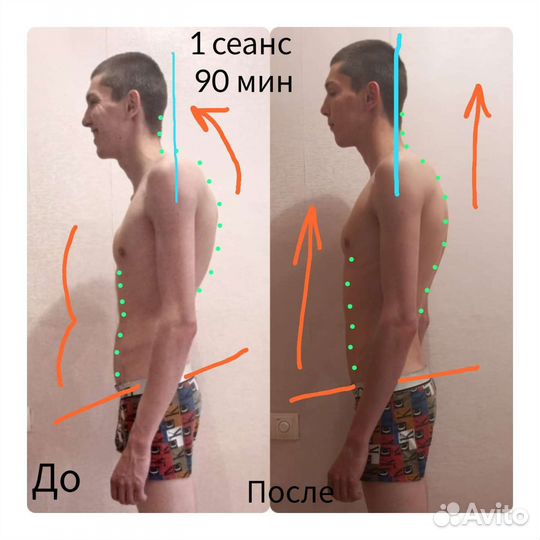 Профессиональный оздоровительный массаж