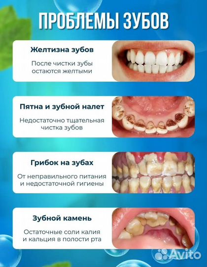 Ультразвуковой скалер