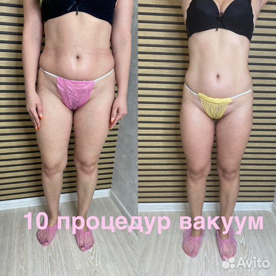 Аппаратная коррекция фигуры и лица