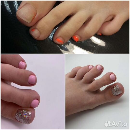 Педикюр на дому