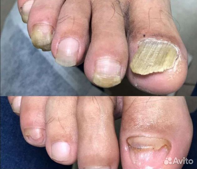 Эстетика.Мед.педикюр(Подология).Выезд на дом