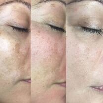 Bb Glow - ваша кожа идеальна каждый день, Можайск
