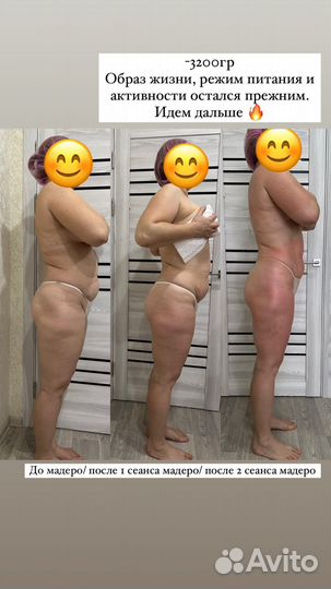 Мадеротерапия скалками